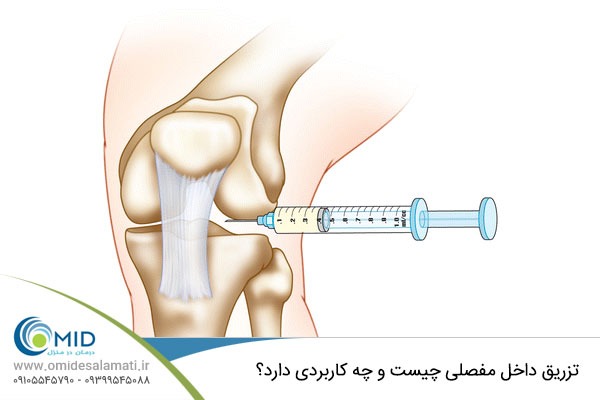تزریق مفصلی در منزل توسط پزشک متخصص؛ بهترین روش تسکین درد در خانه 2 تزریق مفصلی در منزل توسط پزشک متخصص؛ بهترین روش تسکین درد در خانه -